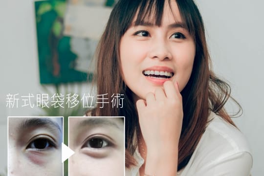 淚溝=累溝?輕熟女小晴真心分享