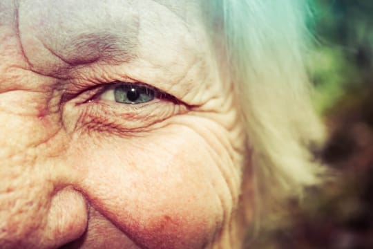 消失的雙眼皮和突出的眼袋 / 老化和挽救老化之一